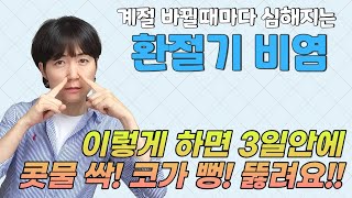 지긋지긋한 환절기비염!   이렇게하면 3일안에 콧물 싹! 코가 뻥뚫립니다!!