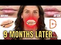 LED Plump Lips without Filler? Testing Dr. Dennis Gross LED Lip Spectralite Lipware PRO