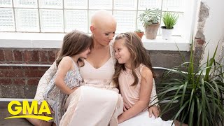 Mom with alopecia opens up about hair loss journey and her message to her daught