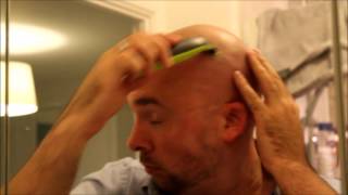 Philips One Blade Head shave