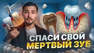 Большие ПЛОМБЫ- СМЕРТЬ для твоих ЗУБОВ, и почему КОРОНКА- единственное твое спасение