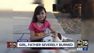 Neighbor speaks out after girl, father were severely burned in Phoenix