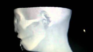 VTK Human Head Visualization 2