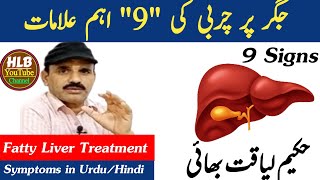 9 Signs Of Fatty Liver in Urdu/Hindi | Symptoms & Treatment | Hakeem Liaqat Bhai