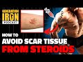 How To Avoid Scar Tissue From Steroid Injections In Bodybuilding | Generation Iron Podcast