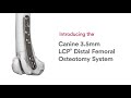 Distal Femoral Osteotomy System