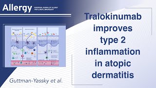 Targeting IL 13 with tralokinumab normalizes type 2 inflammation in atopic dermatitis