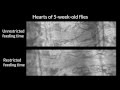 Fly hearts beat to the rhythm of mealtime | Science News