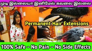 முடி இல்லையா இனிமேல் கவலை இல்லை, 100% Safe, No Pain, No Side Effects, Permanent Hair Extensions