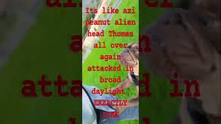 @TheSwan AZI PEANUT ALIEN HEAD THOMAS'S ATTACK ON GORD KILLER WATTS ADHD FAM re-enacts azi judis🏴‍☠️