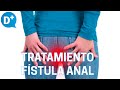 Diagnóstico y tratamiento de la fístula anal