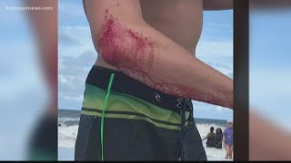 Jax Beach surfer not afraid of the water after shark bite