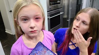 Trinity Has an Allergic Reaction!!! Her Eye is Swollen!