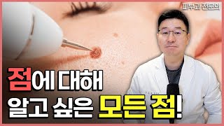 피부과 전문의가 알려주는 점에 대한 모든 점 (점의종류, 흉터없이점빼기, 사용되는 레어저 시술법 등)