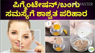 ಬಂಗು ನಿವಾರಣೆಗೆ ಸುಲಭ ಮನೆಮದ್ದು ಇಲ್ಲಿದೆ//home remedies for pigmentation in Kannada//aarogyasalahe tips