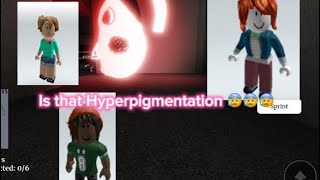 Playing Escape Hyperpigmentation on roblox😰warning flashing red lights Horror