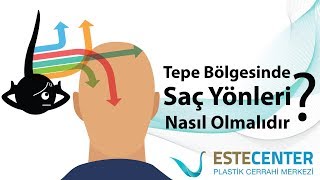 Tepe Bölgesinde Saç Yönleri Nasıl Olmalıdır?