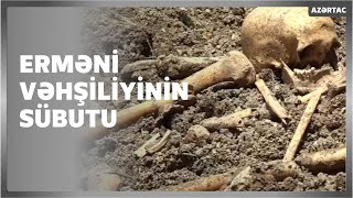 Şuşada kütləvi məzarlıq aşkarlandı - Erməni vəhşiliyinin daha bir sübutu