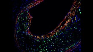 Potential ‘Fountain of Youth’ Gene May Offer Way to Block Detrimental Effects of Aging
