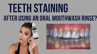 Teeth-Staining After Using Chlorhexidine Gluconate Mouthwash | Can the oral rinse stain teeth?