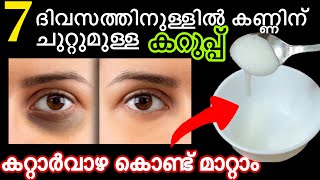 കണ്ണിന് ചുറ്റുമുള്ള കറുപ്പ് മാറാൻഇത് ഒരു തുള്ളി എന്നും രാത്രി ഇതൊന്നു തടവിയാൽ മതി