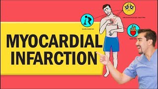 Myocardial Infarction (Heart Attack) for Nursing & NCLEX