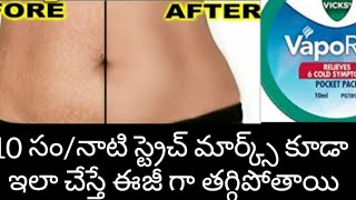 How To Remove Stretch Marks Essily\u0026Naturally/ 10 సం/ నాటి స్ట్రెచ్ మార్క్స్ కూడా ఈజీగా గా తగ్గుతాయి