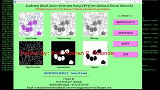 Leukemia Blood Cancer Detection Using CNN With Source Code | Leukemia Detection Using Python Code