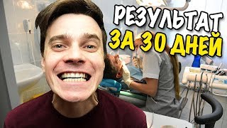 ЗУБЫ Результат лечения за 30 дней | Лечение зубов часть 6