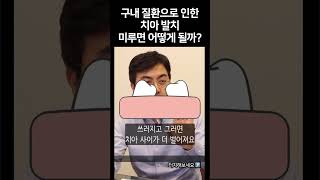 '발치 해야 해요!' 쓸만 한 것 같은데 발치 하라고 하는 이유는?