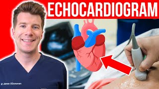 Doctor explains Echocardiogram Heart Test | Everything you need to know