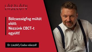 Bölcsességfog műtét előtt: nézzünk CBCT-felvételt együtt!