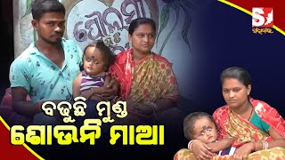 ୪ ବର୍ଷ ଛୋଟ ଶିଶୁର ଅସ୍ୱଭାବିକ ବଢୁଛି ମୁଣ୍ଡ, ବାପ. ମାଆଙ୍କ ପାଖରେ ଚିକିତ୍ସା ପାଇଁ ନାହିଁ ଅର୍ଥ