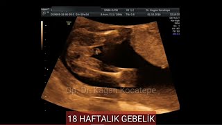 18 HAFTALIK (YAKLAŞIK 4 AYLIK) GEBELİK: ERKEK BEBEK ULTRASONOGRAFİDE NASIL GÖRÜNÜR?