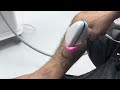 gentlemax 755nm alexandrite and 1064nm nd yag laser introduction