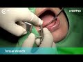 cybermed clinical report 46 47 implant placement