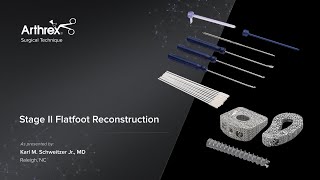 Stage II Flatfoot Reconstruction