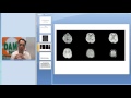 #Radiology Spotter Series-26 #PRES