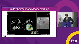Seeing differently, treating better: advanced imaging shaping modern structural heart practice