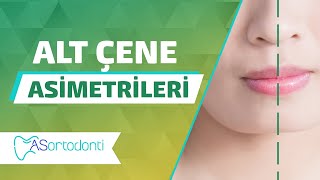 Alt Çene Asimetrileri | AS Ortodonti