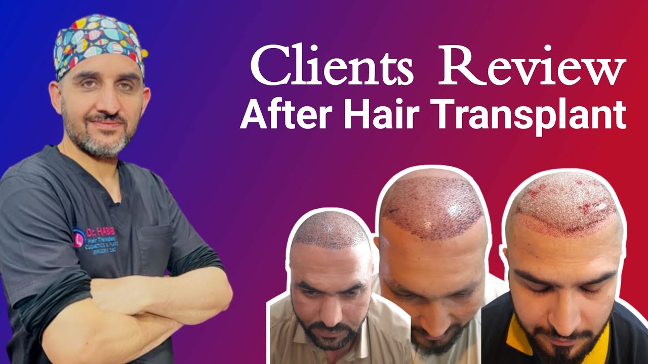 Clients Review After Hair Transplant || Dr. Habib Ullah Shah - YouTube