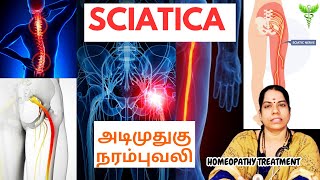 அடிமுதுகு நரம்புவலி Relieve Sciatica Pain: Symptoms, Remedies \u0026 Homeopathy Explained (Tamil)