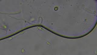 Mikroskop Altında Sperm