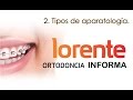 Lorente Ortodoncia Informa - Tipos de aparatología