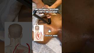 This is what your Rhomboid Pain Needs right now!!! #rhomboids #backpainrelief #scraper