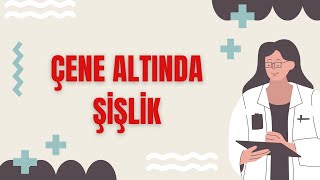 Çene Altında Şişlik Hakkında Bilmeniz Gereken Her Şey