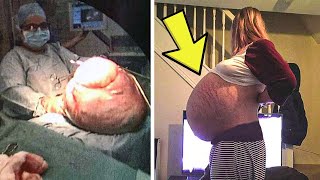Woman's Stomach Just Keeps Getting Bigger Then She Realizes Shes Not Pregnant!
