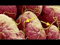 Home Remedies To Get Rid Of Pinworms Forever !! Home Remedies To Get Rid Of Pinworms Forever !!