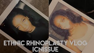 Ethnic Rhinoplasty | Turkey | Dr. Emrah