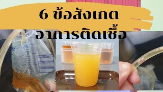 6 ข้อสังเกตอาการติดเชื้อ ผู้ป่วยติดเตียง ใส่สายปัสสาวะ